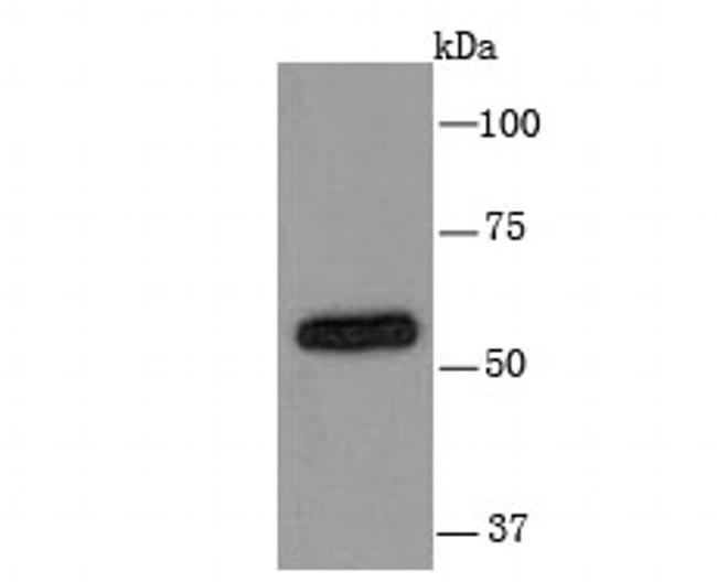 CYP2D6 Antibody in Western Blot (WB)