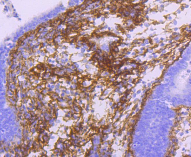 TGFBI Antibody in Immunohistochemistry (Paraffin) (IHC (P))