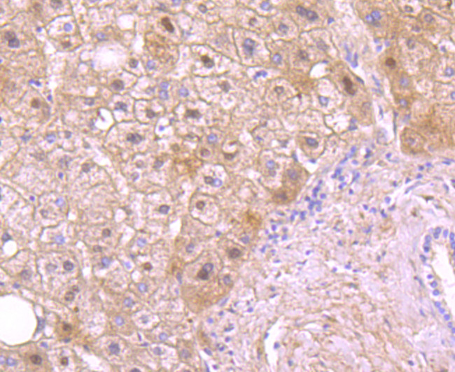 Protein C Antibody in Immunohistochemistry (Paraffin) (IHC (P))