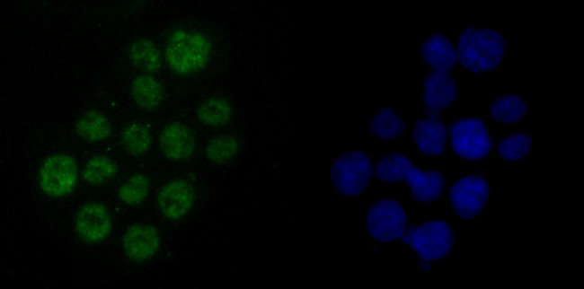 DDX5 Antibody in Immunocytochemistry (ICC/IF)