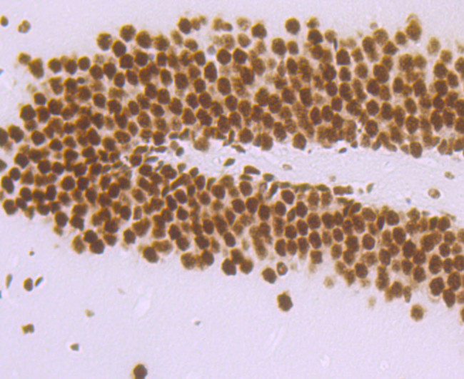 DDX5 Antibody in Immunohistochemistry (Paraffin) (IHC (P))