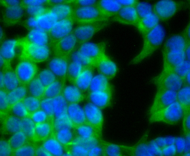 Ephrin B2 Antibody in Immunocytochemistry (ICC/IF)