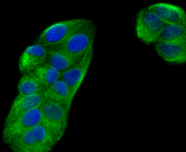 Ephrin B2 Antibody in Immunocytochemistry (ICC/IF)