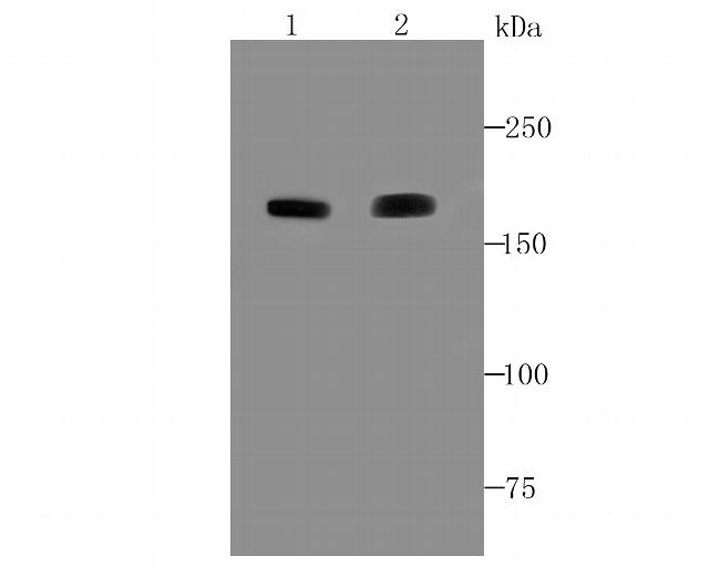 ACE Antibody in Western Blot (WB)