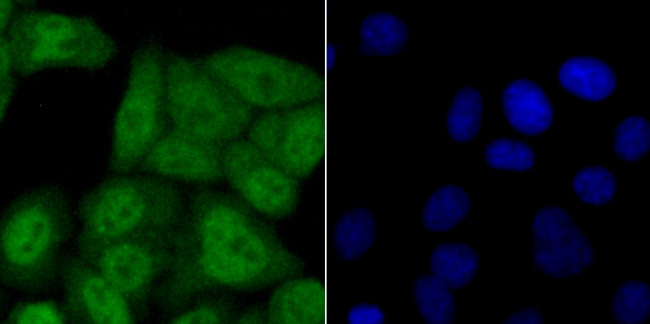 USP11 Antibody in Immunocytochemistry (ICC/IF)