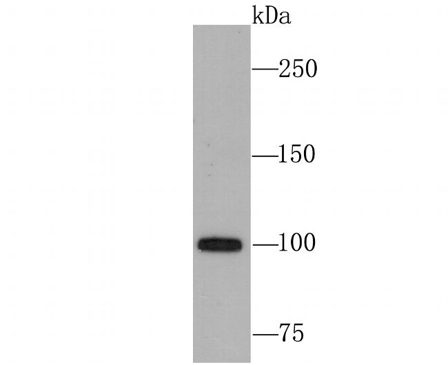 USP11 Antibody in Western Blot (WB)