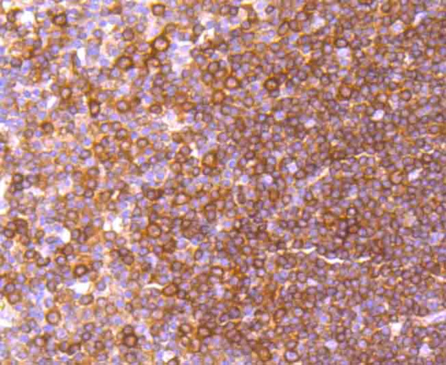 c-Rel Antibody in Immunohistochemistry (Paraffin) (IHC (P))