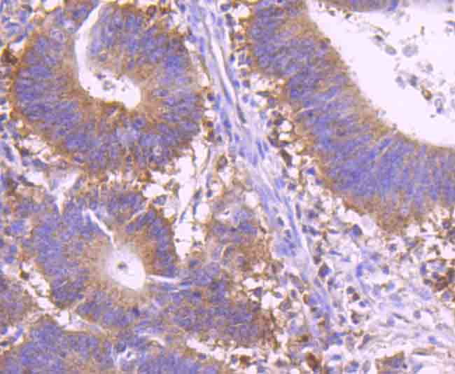 c-Rel Antibody in Immunohistochemistry (Paraffin) (IHC (P))