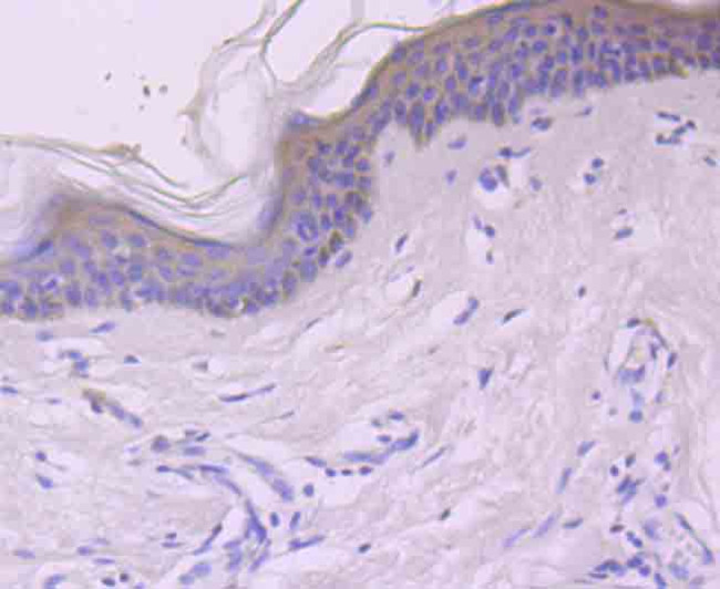 c-Rel Antibody in Immunohistochemistry (Paraffin) (IHC (P))