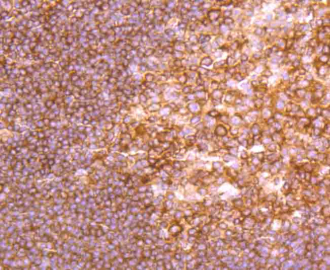 NFkB p52 Antibody in Immunohistochemistry (Paraffin) (IHC (P))