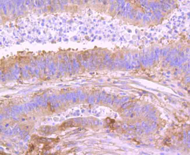 NFkB p52 Antibody in Immunohistochemistry (Paraffin) (IHC (P))