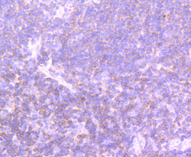 PIK3CD Antibody in Immunohistochemistry (Paraffin) (IHC (P))