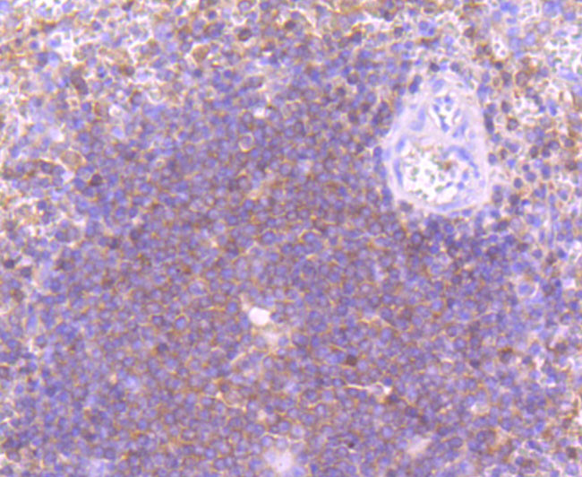 PIK3CD Antibody in Immunohistochemistry (Paraffin) (IHC (P))