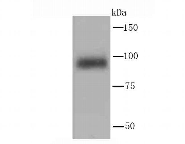 PIK3CD Antibody in Western Blot (WB)