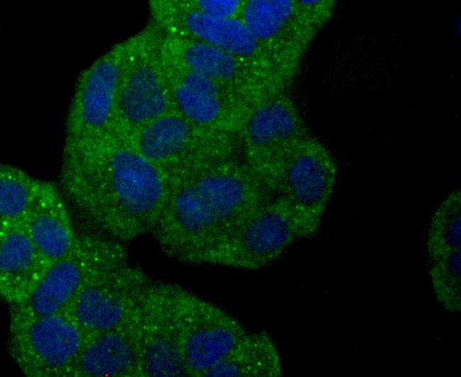 gamma Synuclein Antibody in Immunocytochemistry (ICC/IF)