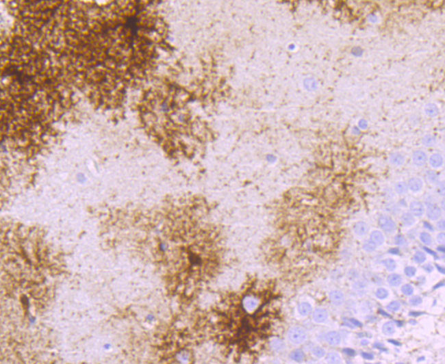 gamma Synuclein Antibody in Immunohistochemistry (Paraffin) (IHC (P))