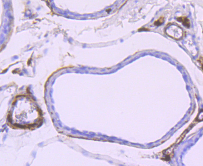 gamma Synuclein Antibody in Immunohistochemistry (Paraffin) (IHC (P))