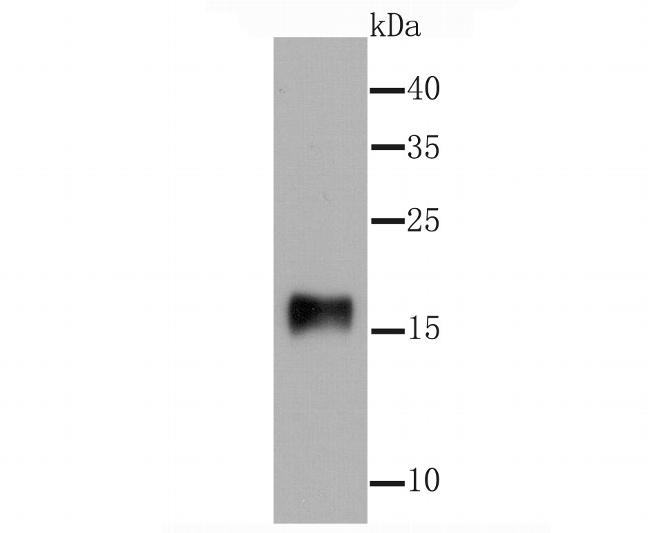 gamma Synuclein Antibody in Western Blot (WB)