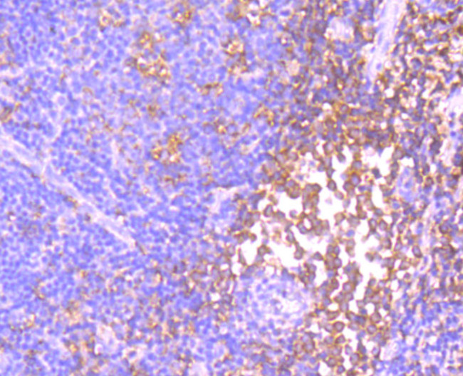 ID1 Antibody in Immunohistochemistry (Paraffin) (IHC (P))