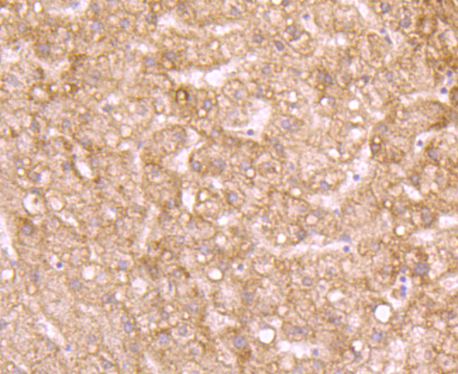 ID1 Antibody in Immunohistochemistry (Paraffin) (IHC (P))