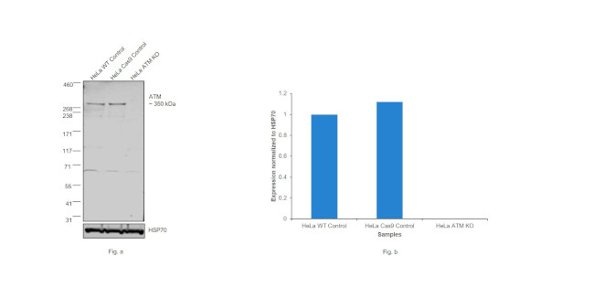 Phospho-ATM (Ser1981) Antibody