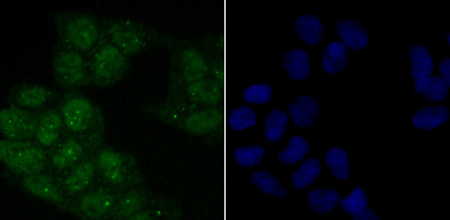 Phospho-ATM (Ser1981) Antibody in Immunocytochemistry (ICC/IF)