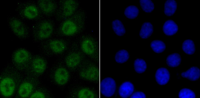 Phospho-ATM (Ser1981) Antibody in Immunocytochemistry (ICC/IF)