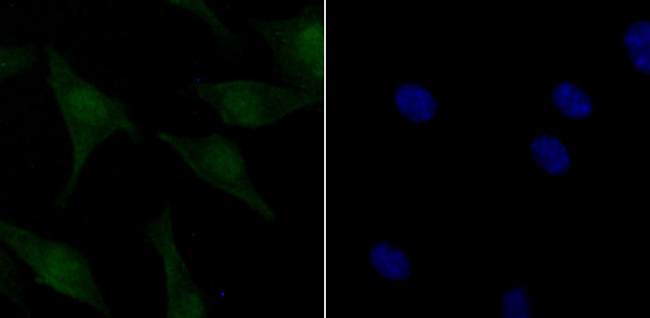 Phospho-ATM (Ser1981) Antibody in Immunocytochemistry (ICC/IF)