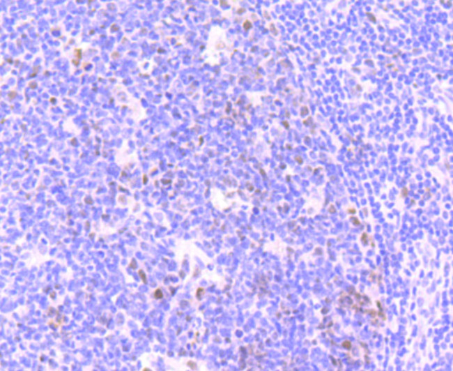 Phospho-ATM (Ser1981) Antibody in Immunohistochemistry (Paraffin) (IHC (P))