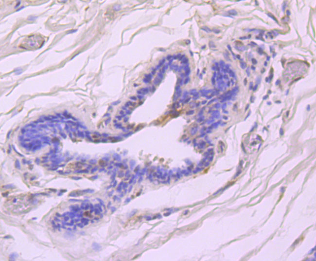 Phospho-ATM (Ser1981) Antibody in Immunohistochemistry (Paraffin) (IHC (P))