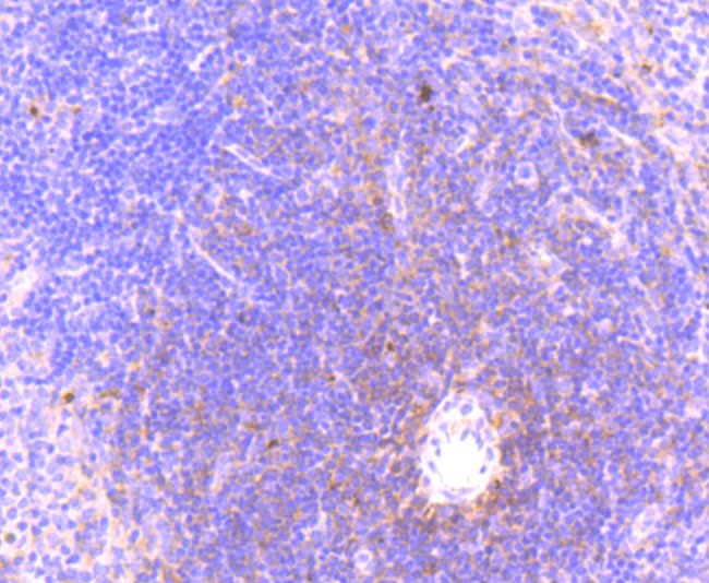 Phospho-MLKL (Ser345) Antibody in Immunohistochemistry (Paraffin) (IHC (P))