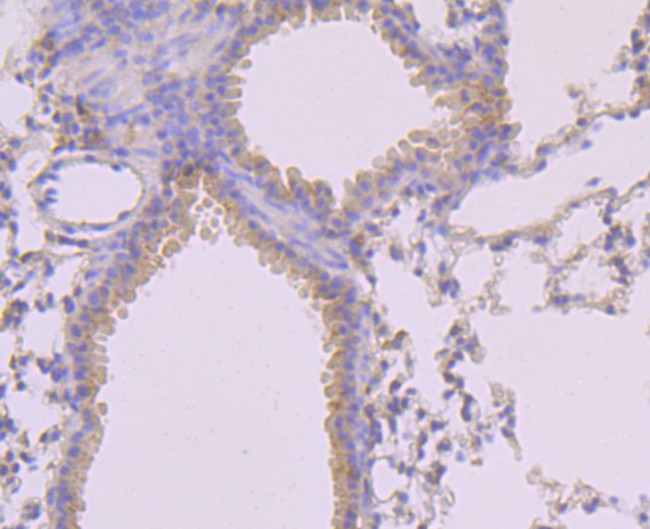 Phospho-MLKL (Ser345) Antibody in Immunohistochemistry (Paraffin) (IHC (P))