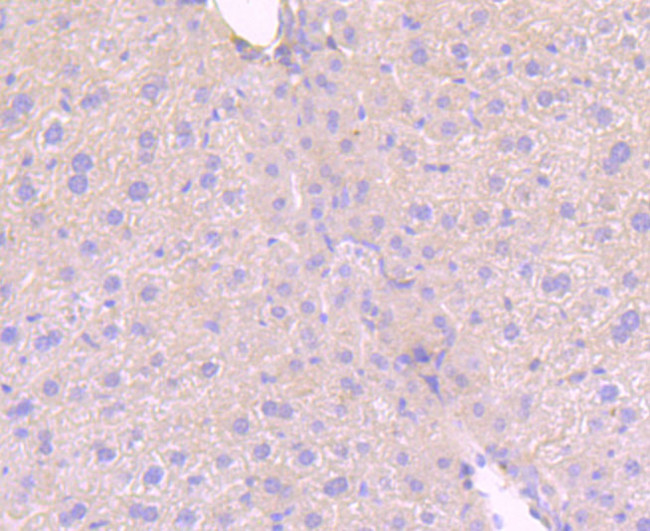 Phospho-MLKL (Ser345) Antibody in Immunohistochemistry (Paraffin) (IHC (P))