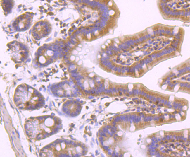 Phospho-MLKL (Ser345) Antibody in Immunohistochemistry (Paraffin) (IHC (P))