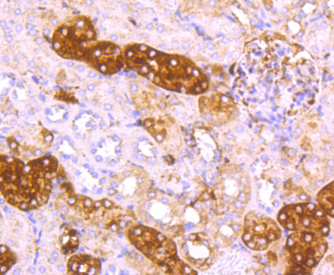 Ferritin Light Chain Antibody in Immunohistochemistry (Paraffin) (IHC (P))