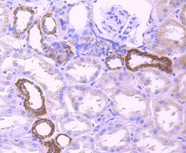 PDHB Antibody in Immunohistochemistry (Paraffin) (IHC (P))