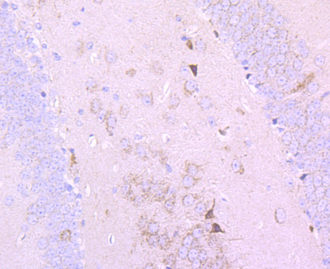 PDHB Antibody in Immunohistochemistry (Paraffin) (IHC (P))