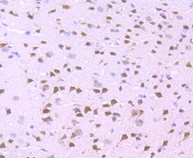 WDR5 Antibody in Immunohistochemistry (Paraffin) (IHC (P))