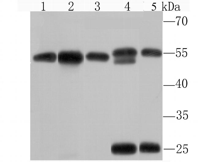 KPNA2 Antibody in Western Blot (WB)