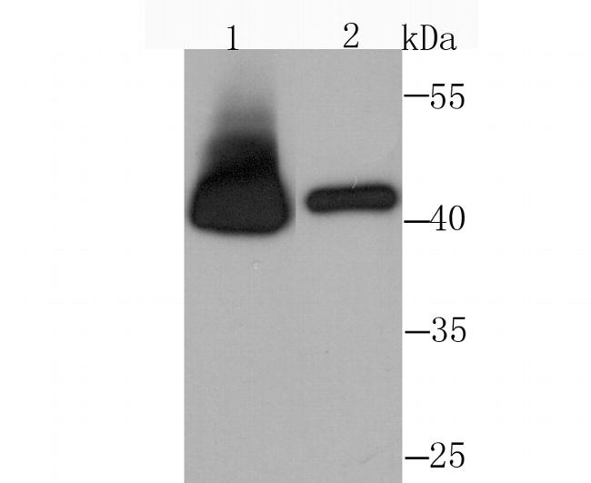 RRM2 Antibody in Western Blot (WB)