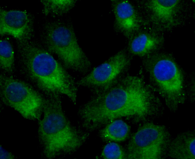 Nogo-B Antibody in Immunocytochemistry (ICC/IF)