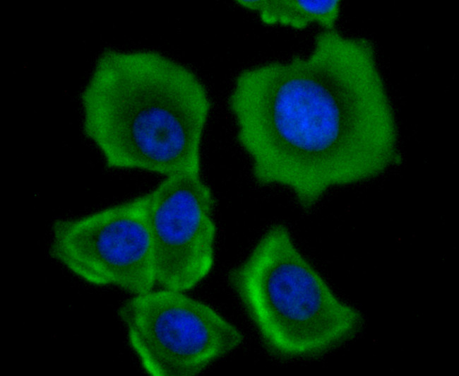 TFAM Antibody in Immunocytochemistry (ICC/IF)