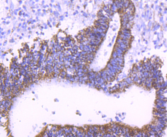 TFAM Antibody in Immunohistochemistry (Paraffin) (IHC (P))