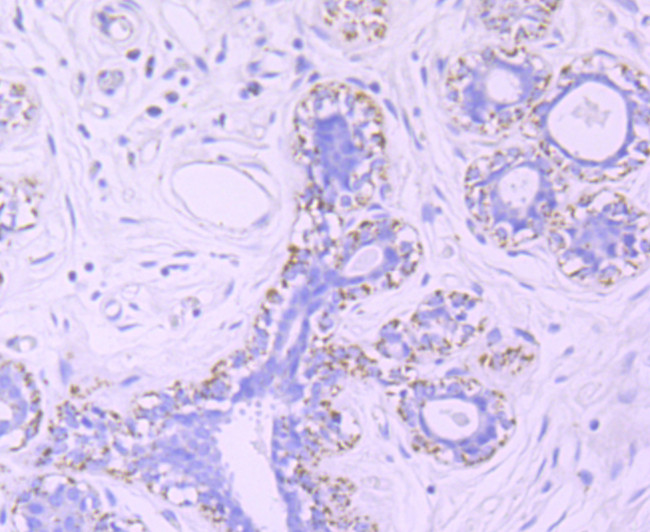 TFAM Antibody in Immunohistochemistry (Paraffin) (IHC (P))