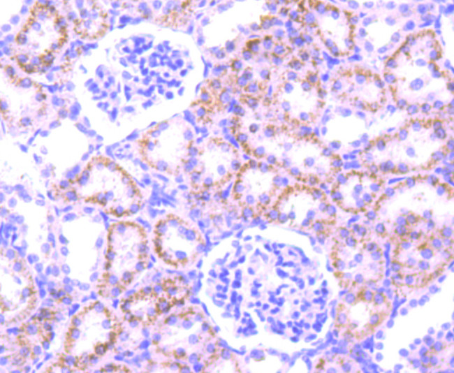 PFKFB3 Antibody in Immunohistochemistry (Paraffin) (IHC (P))