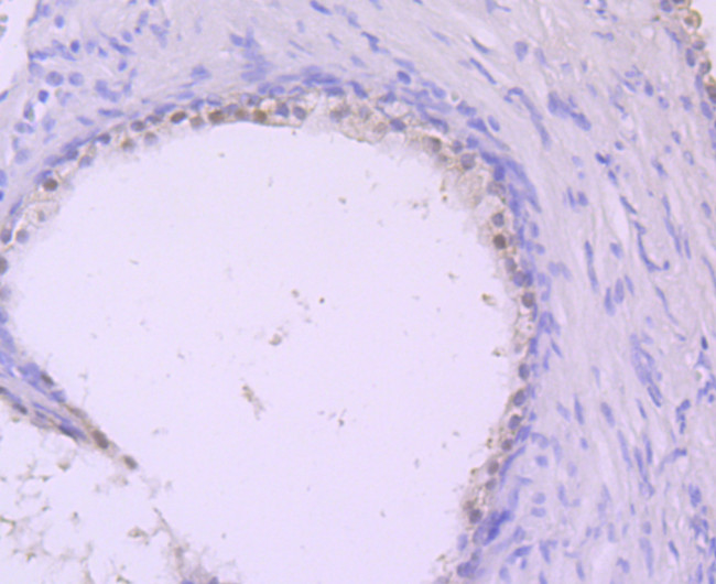 DDAH1 Antibody in Immunohistochemistry (Paraffin) (IHC (P))