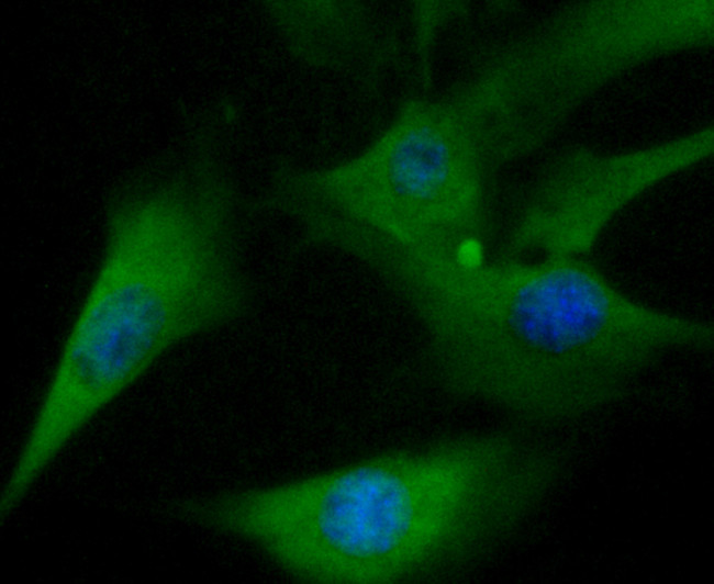 TXNIP Antibody in Immunocytochemistry (ICC/IF)