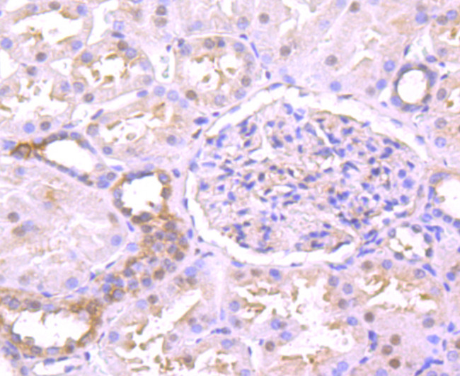 TXNIP Antibody in Immunohistochemistry (Paraffin) (IHC (P))