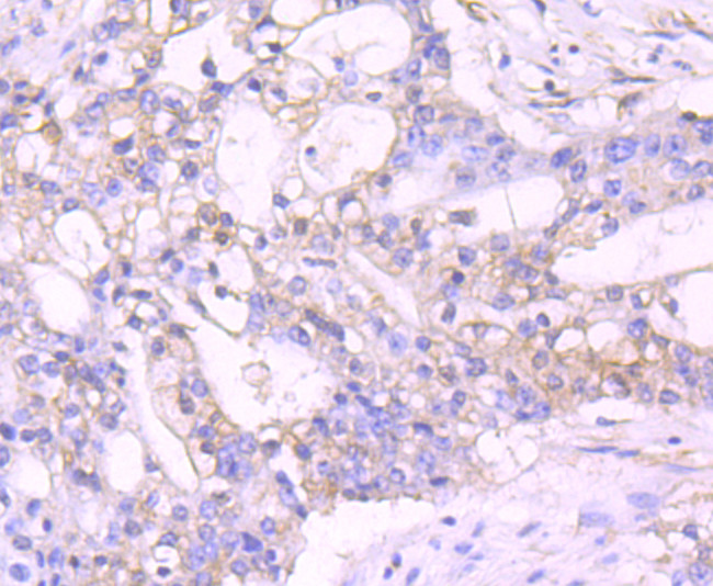 TXNIP Antibody in Immunohistochemistry (Paraffin) (IHC (P))