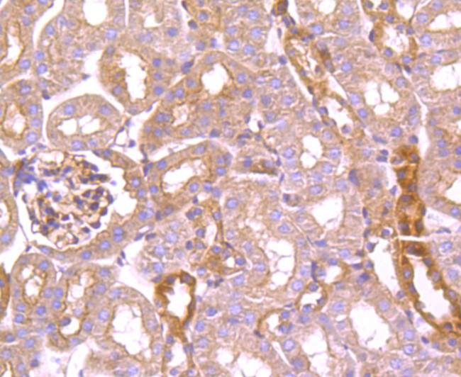 TXNIP Antibody in Immunohistochemistry (Paraffin) (IHC (P))